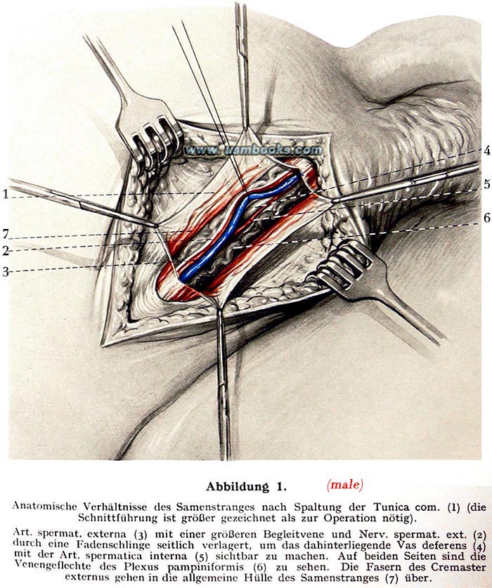 Nazi male sterilization illustration